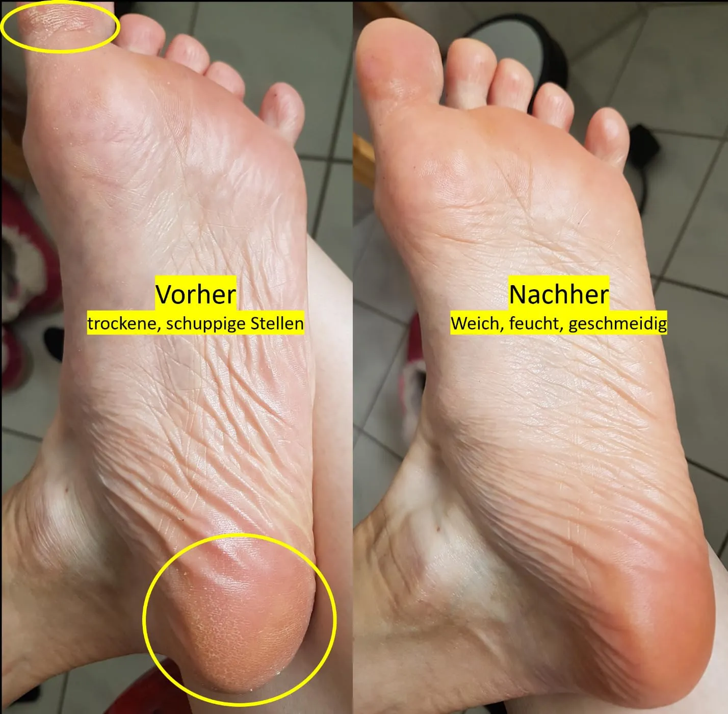 Rugard Schöne Füße Fußbalsam 100 ml rissige Füße