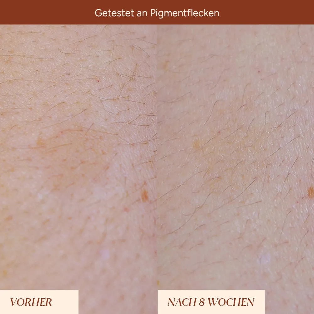 JUNGLÜCK Pigmentflecken Roll-On Serum 5 ml Arbutin