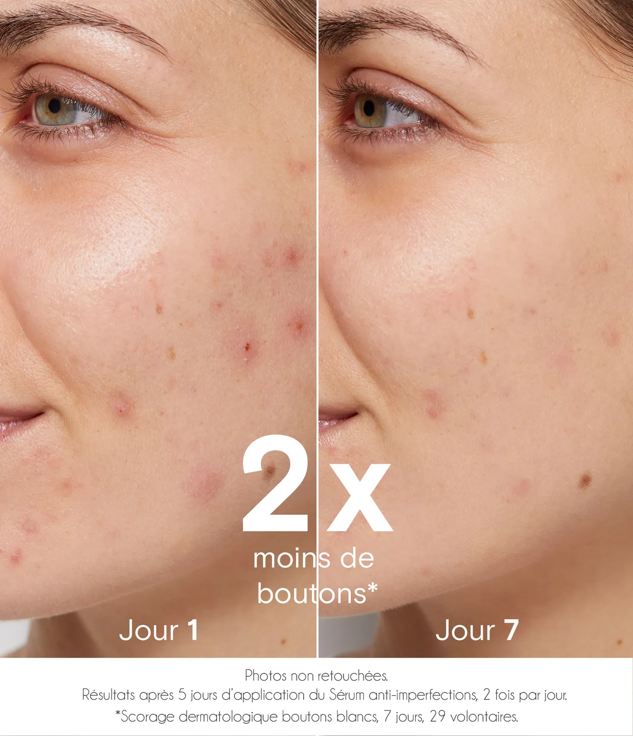 La Rosée Sérum purifiant Gesichtsserum unreine Haut Zink
