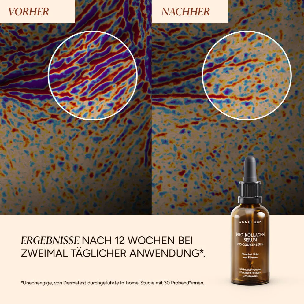JUNGLÜCK Kennenlern Set Linien Falten minimieren Set