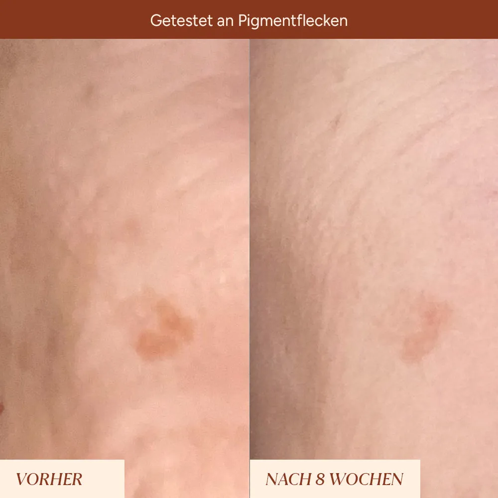 JUNGLÜCK Pigmentflecken Roll-On Serum 5 ml Arbutin